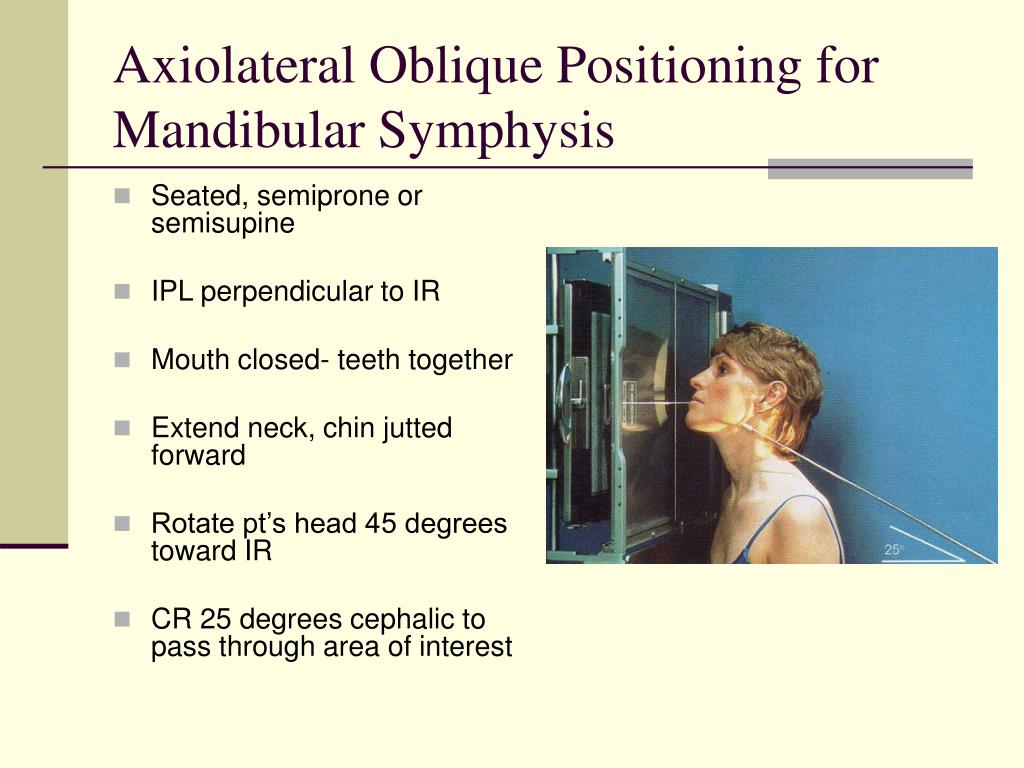 Mandible x ray position