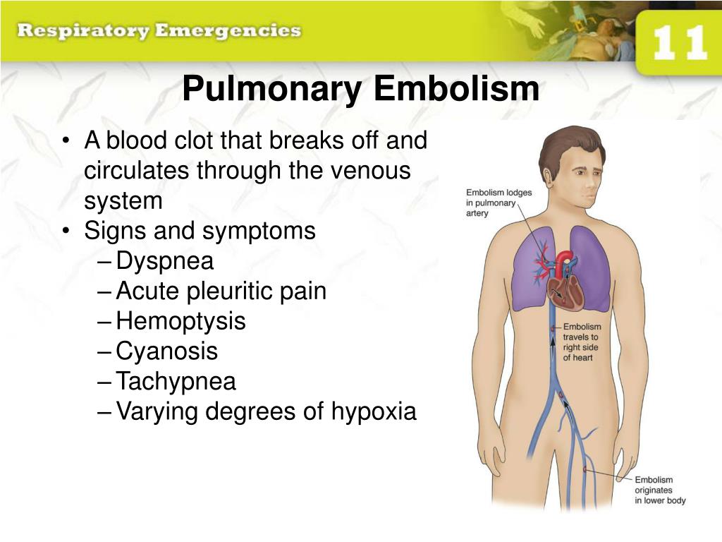 PPT - 11: Respiratory Emergencies PowerPoint Presentation, free ...