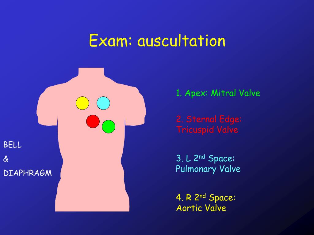 usmle practice test auscultation vsd usmle practice test auscultation vsd