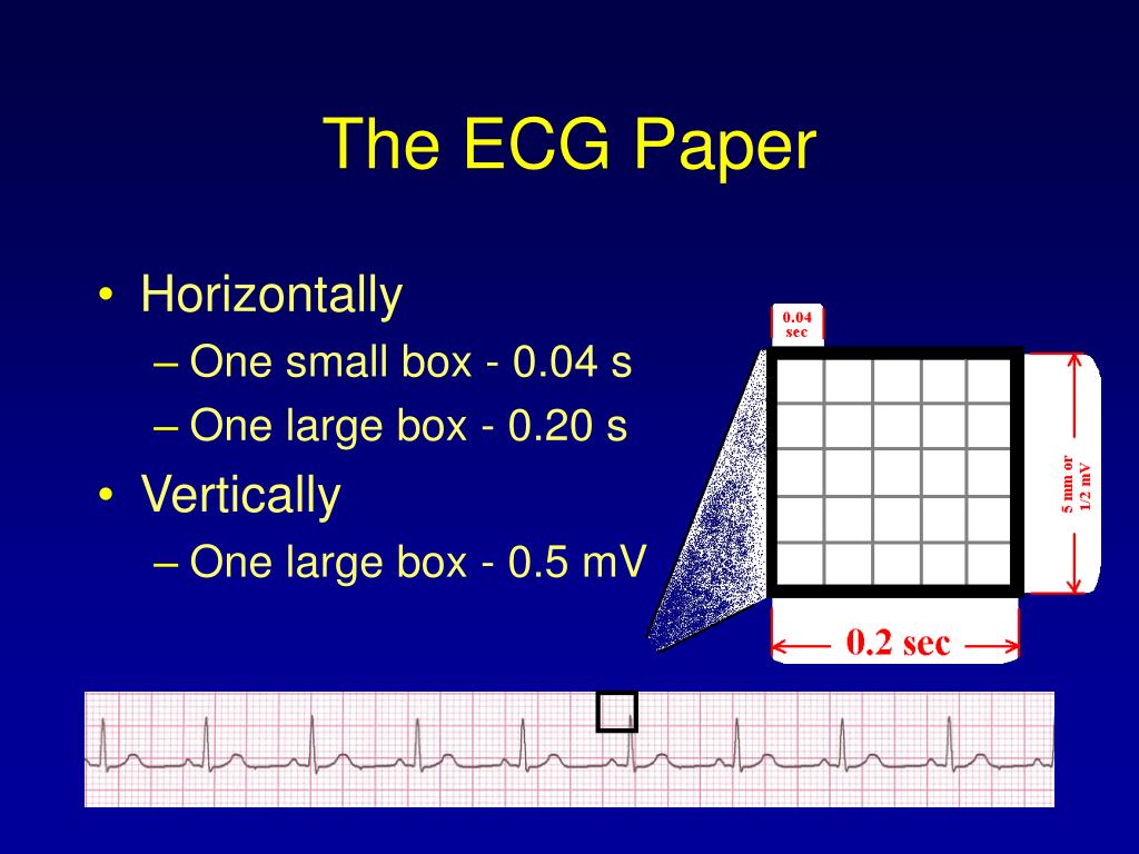 PPT ECG Rhythm Interpretation PowerPoint Presentation free download PPT ECG Rhythm Interpretation PowerPoint Presentation free download