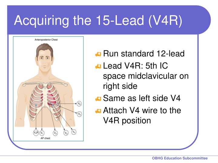 Ppt - Chapter 8 For 12 Lead Training