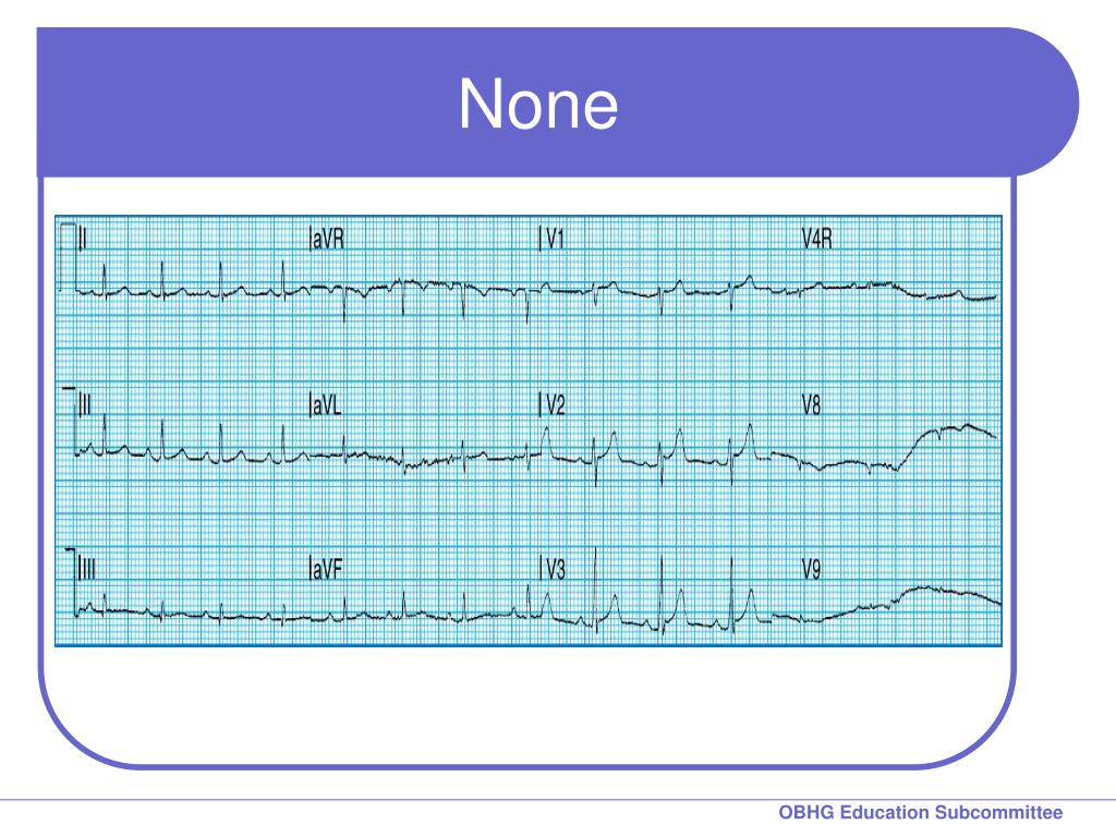 july-pulse-physiology-learning-through-social-education