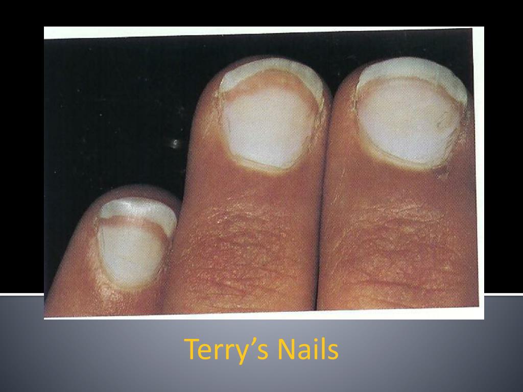 Did You Know #4: What Your Nails Tell about Your Health – Dr. Herbz