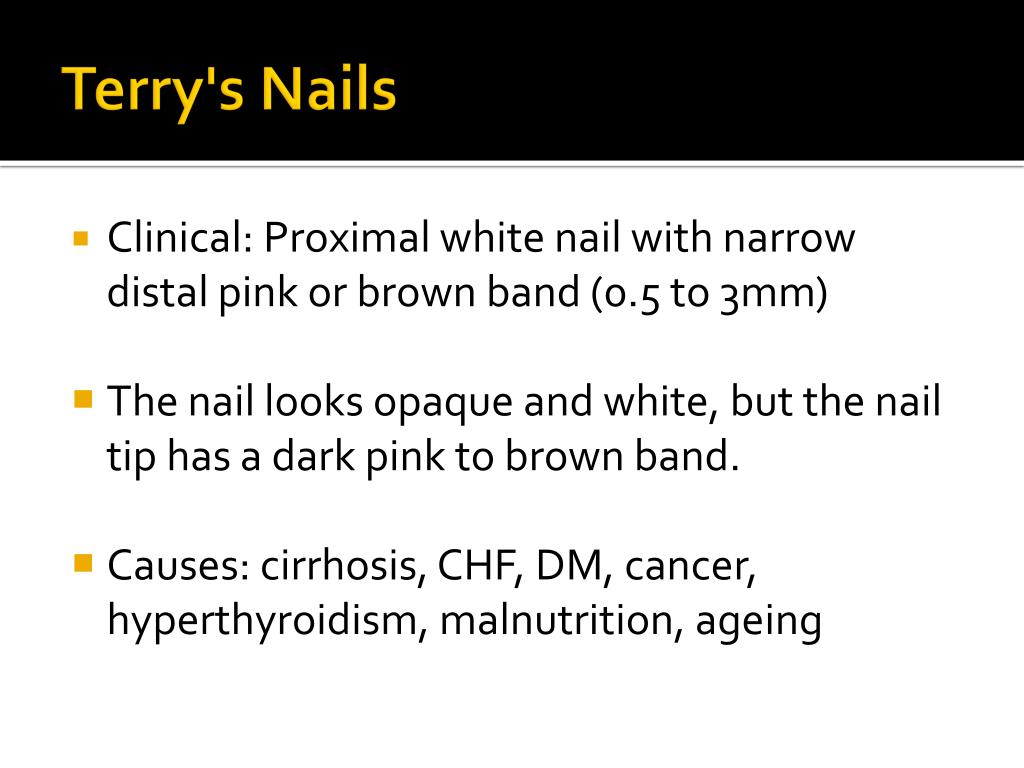 PDF) Plummer's nails (onycholysis) in an adolescent nigerian girl with  hyperthyroidism due to Graves' disease | Alphonsus Onyiriuka - Academia.edu