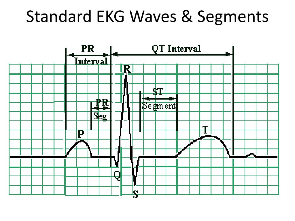 PPT EKG PowerPoint Presentation Free Download ID 296817