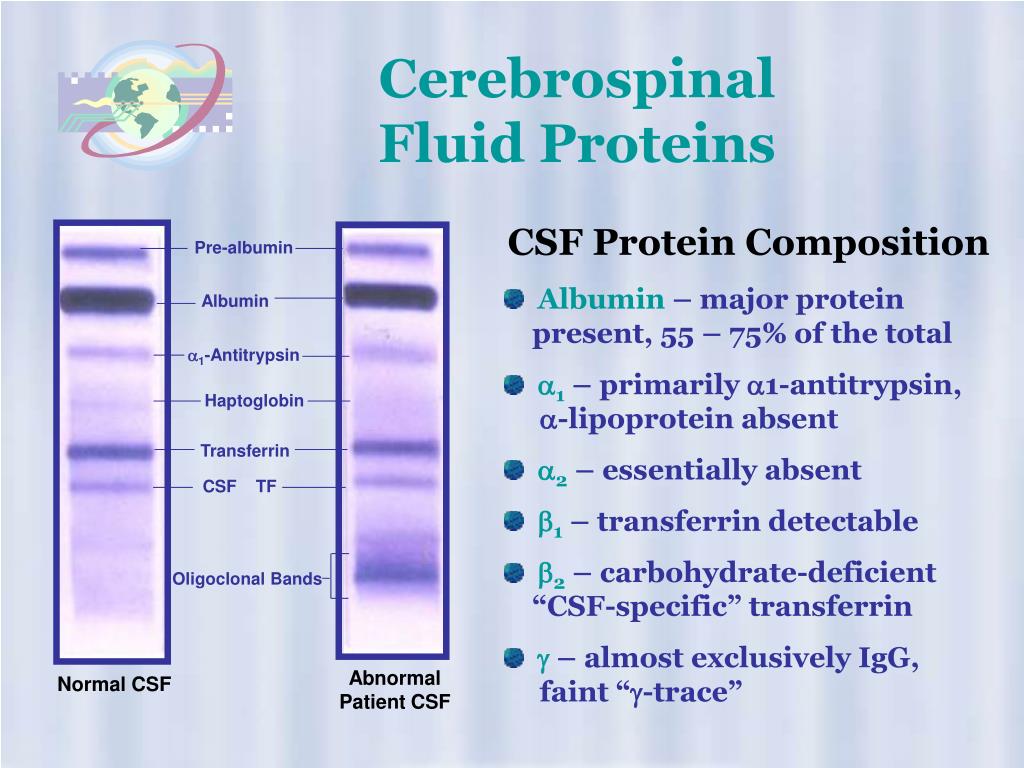 PPT High Resolution Protein Electrophoresis PowerPoint Presentation, free download ID298130