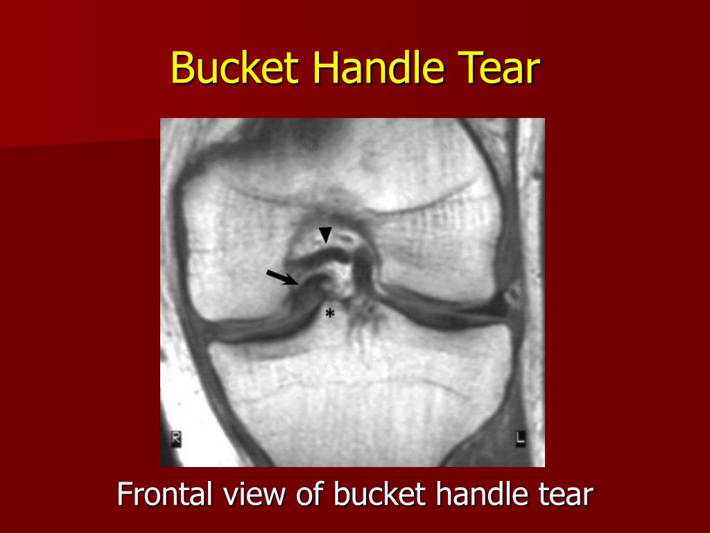 PPT Imaging Of Common Injuries Encountered In Sports Medicine PPT Imaging Of Common Injuries Encountered In Sports Medicine