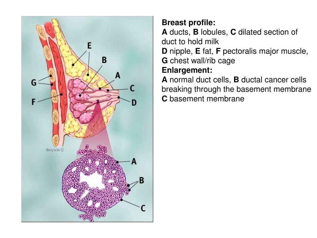 PPT - Diagnosis, Staging, and Grading of Breast Cancer PowerPoint  Presentation - ID:305594