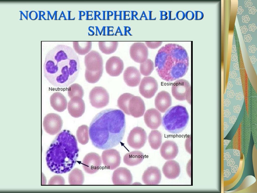 Peripheral Blood Smear Staining Procedure