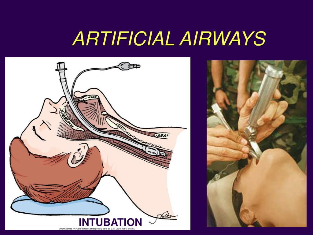 PPT - Module A2: Upper Airway Anatomy & Physiology PowerPoint