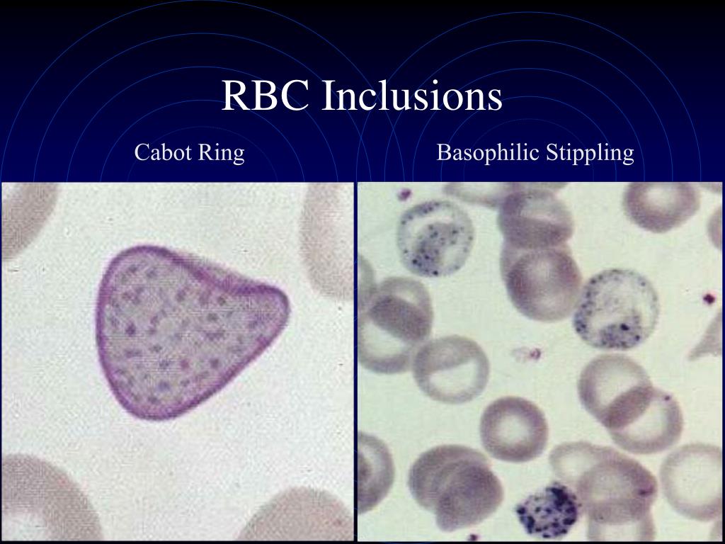 Evaluation of Cell Morphology and Introduction to Platelet and White Blood  Cell Morphology - PDF Free Download