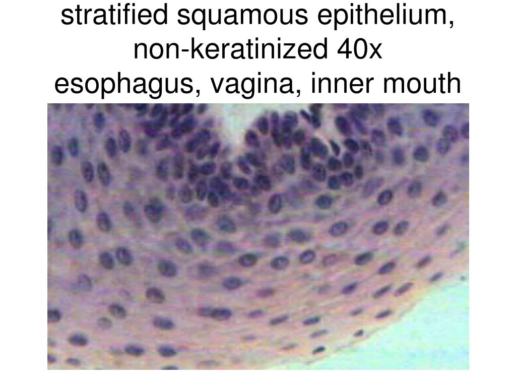 nonkeratinized stratified squamous epithelium mouth