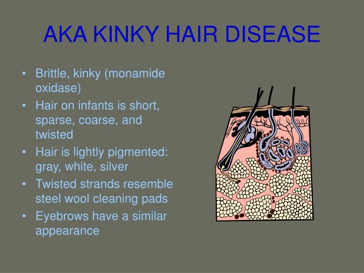 Menkes kinky hair disease Choudhary SV Gadegone RW Koley S  Indian J  Dermatol