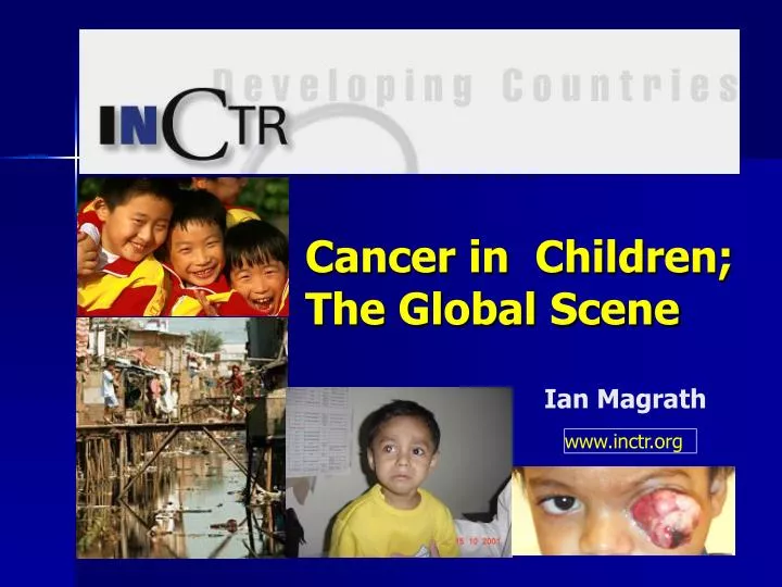 cancer in children the global scene n.