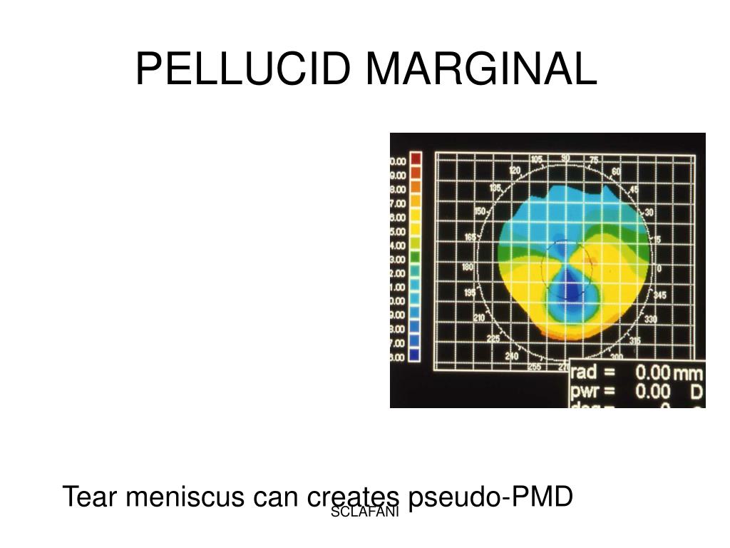 pellucid analytics pellucid analytics