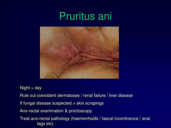 Cures for puritus anus