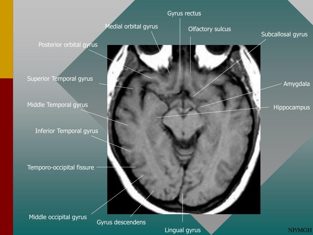 PPT - NORMAL CORTICAL ANATOMY PowerPoint Presentation, free download ...