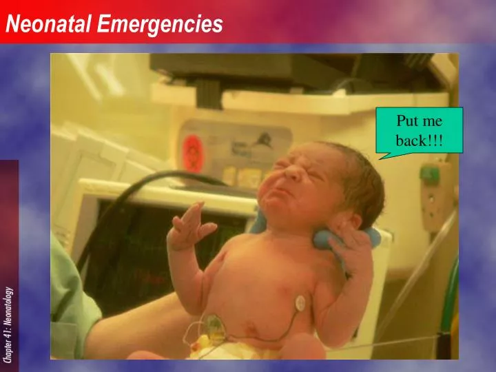 neonatal emergencies n.