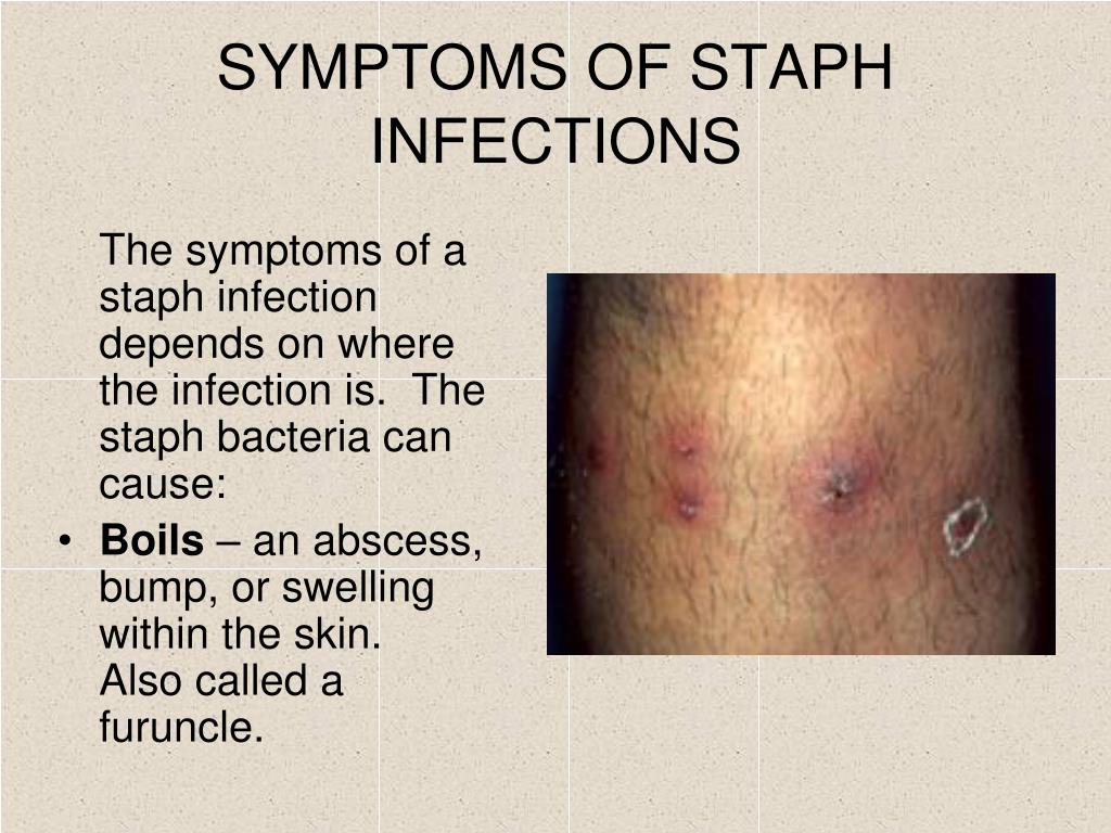 early stage minor staph infection early stage minor staph infection