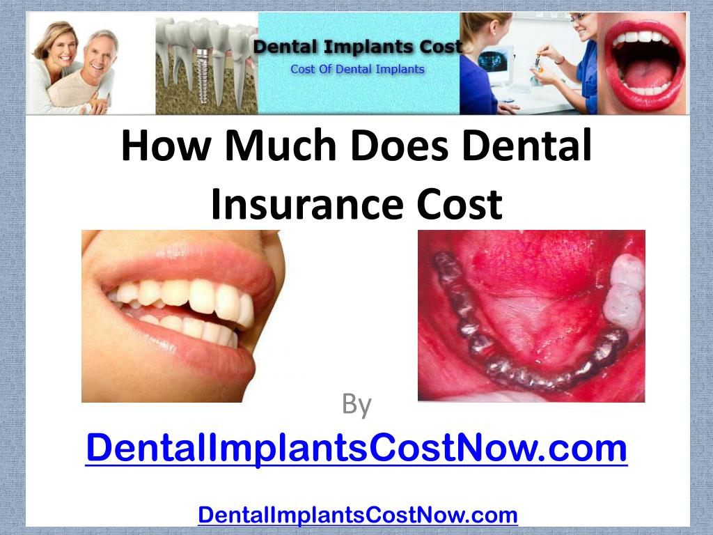 Ppt - How Much Does Dental Insurance Cost Powerpoint Presentation Free Download - Id339586