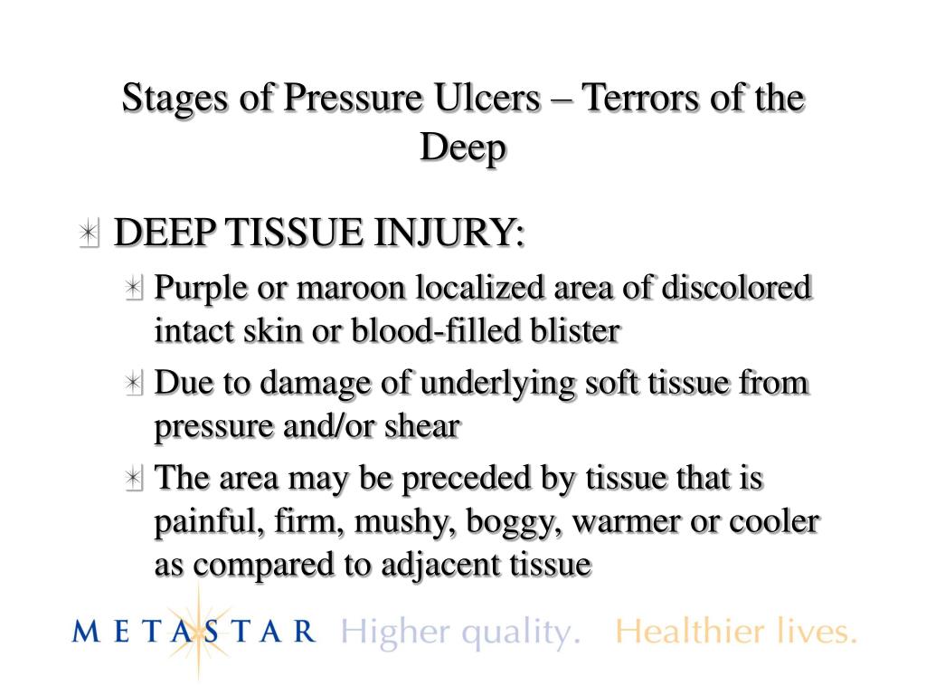 stages of pressure ulcers terrors of the deep l