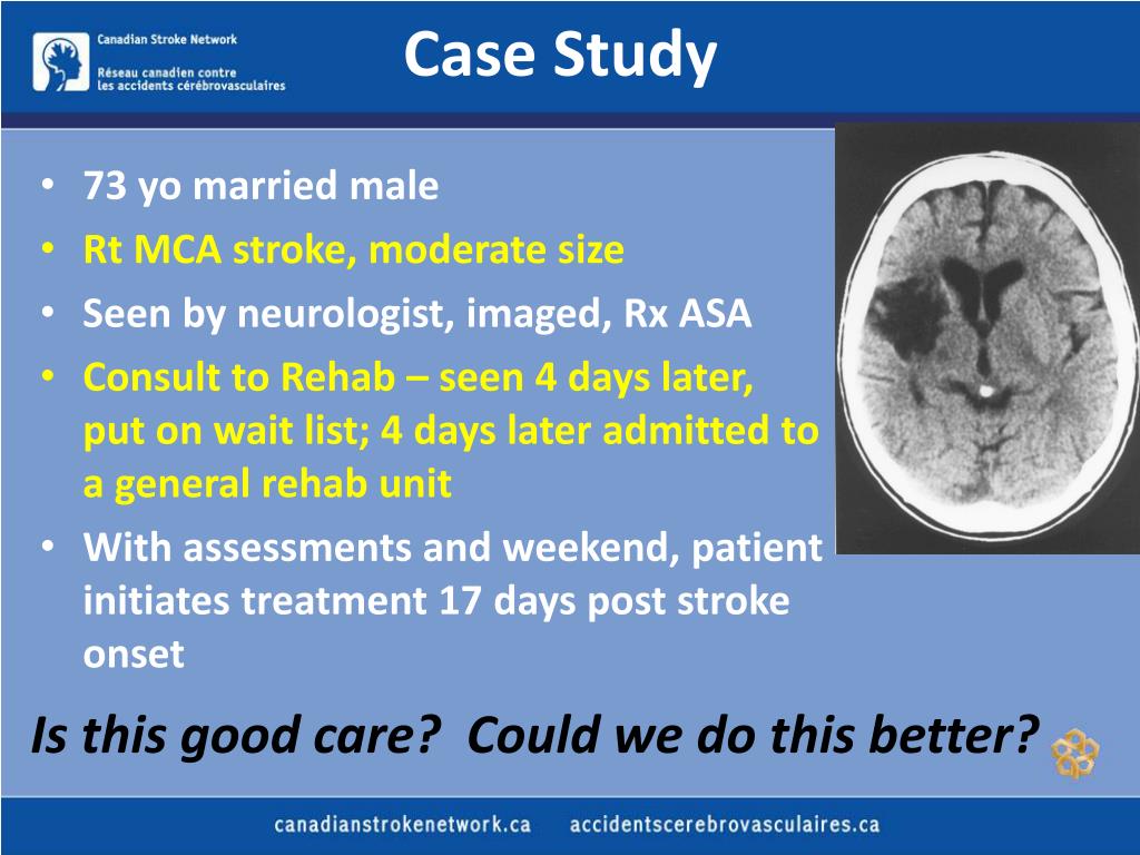 treatment of stroke case study