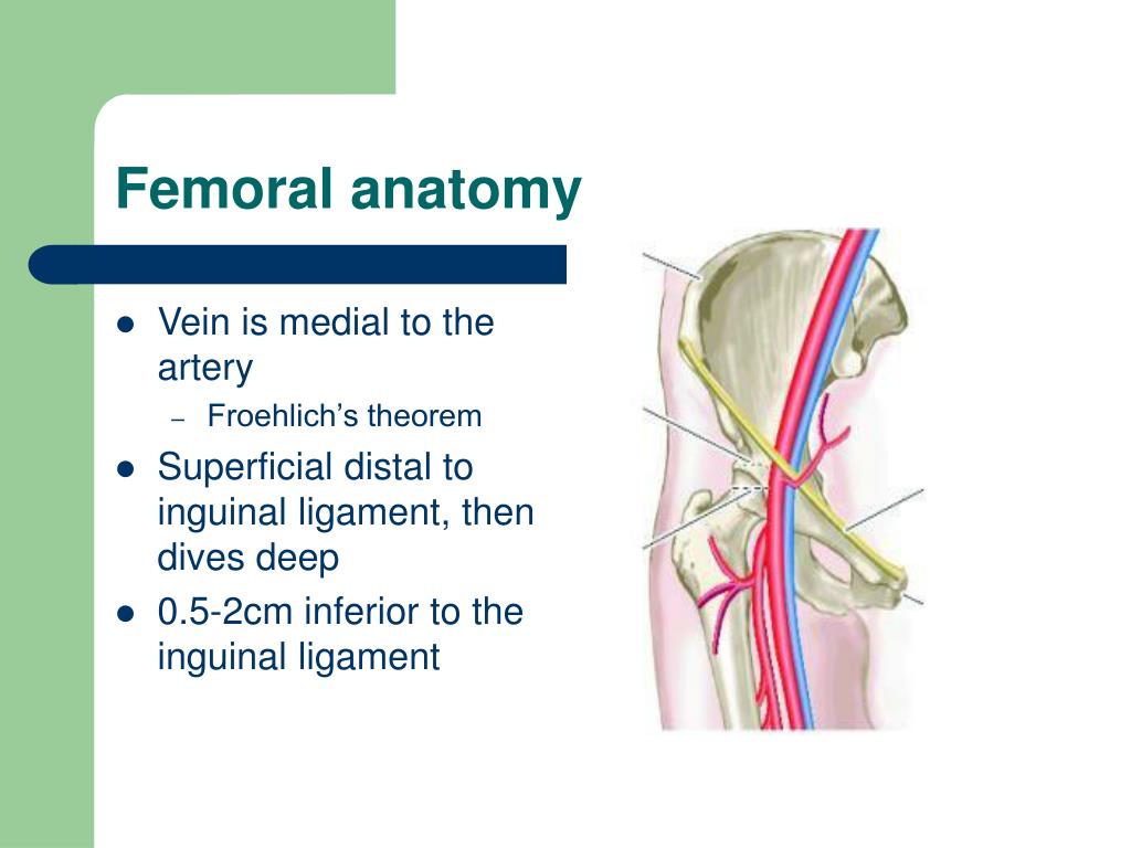 PPT - Venous Access PowerPoint Presentation, free download - ID:349907