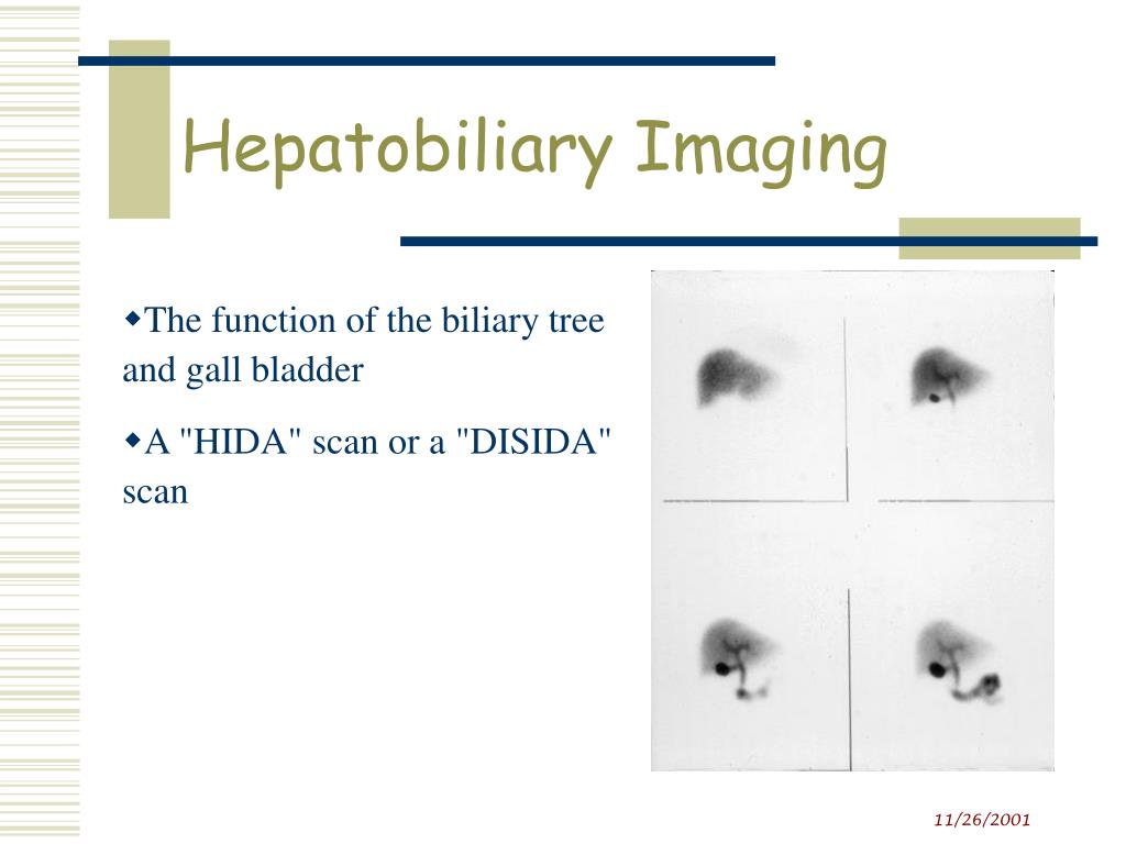 Ppt Hepatobiliary Imaging Powerpoint Presentation Free Download Id