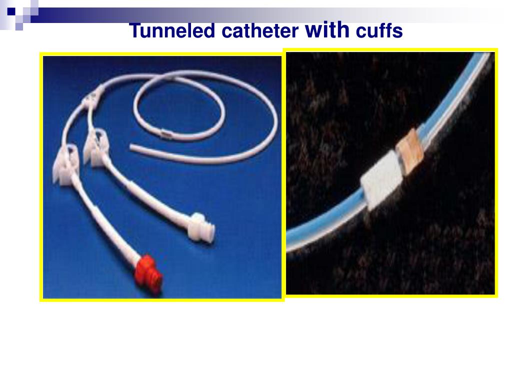 PPT - IV TERAPY & Central Venous Catheters PowerPoint Presentation - ID ...