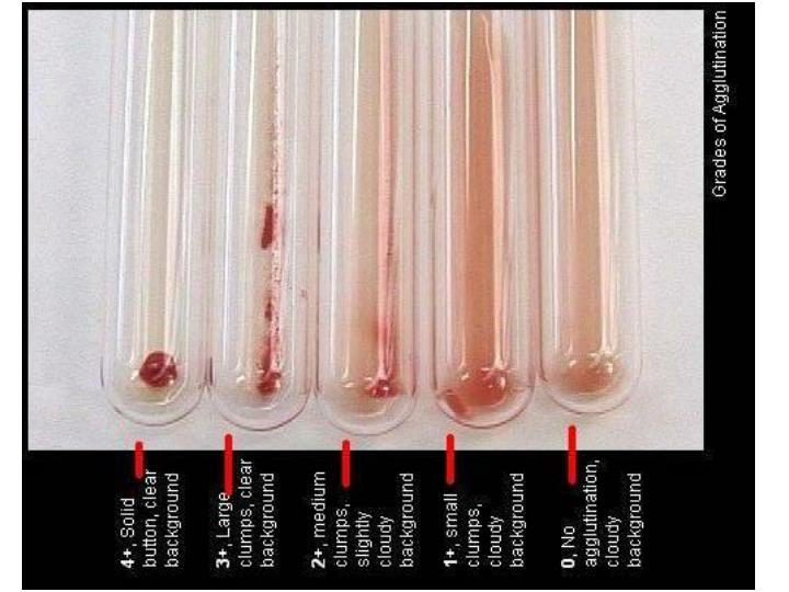 PPT Blood Grouping Slide & Tube Methods PowerPoint Presentation ID