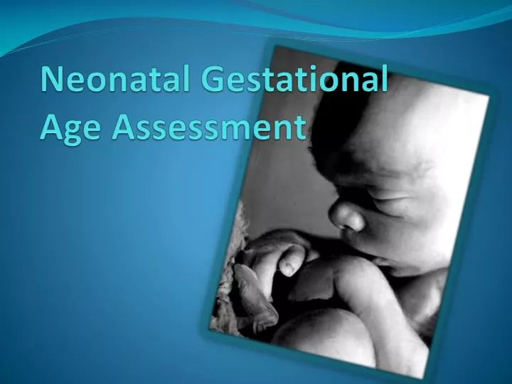 neonatal gestational age assessment n.