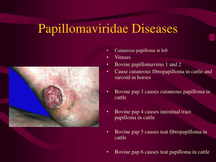 Papillomaviridae diseases
