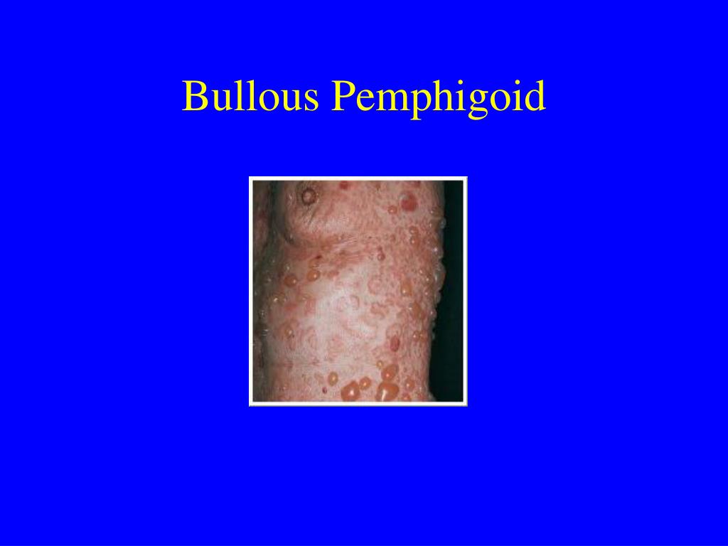 Ppt Cutaneous Manifestations Of Internal Disease Powerpoint Presentation Id362033 