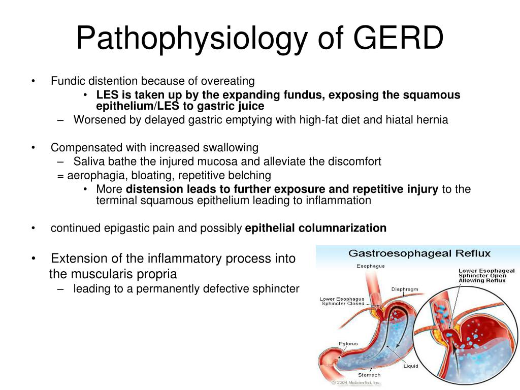 Gerd Pathophysiology Nusagates