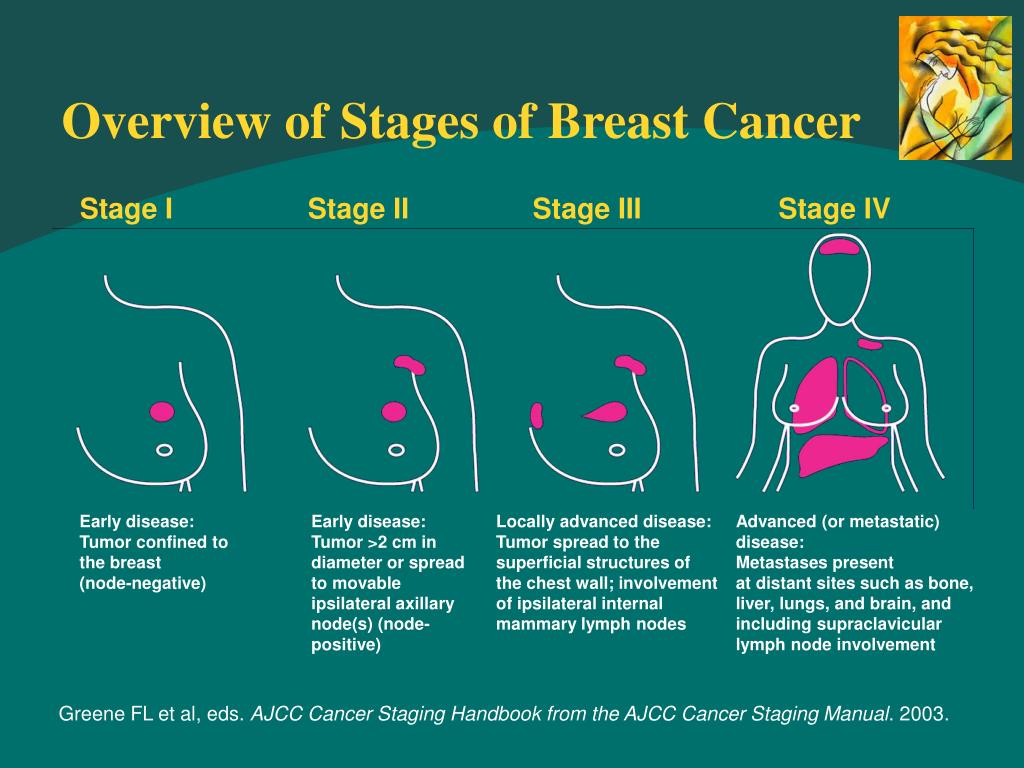 Breast Cancer Symptoms