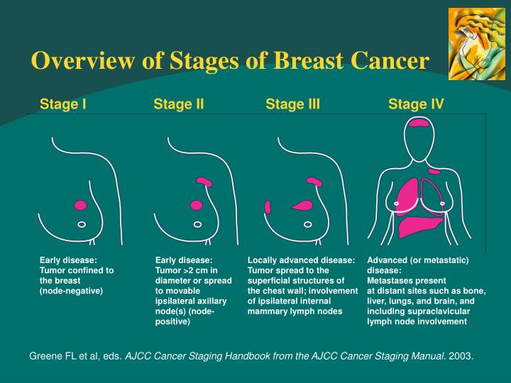 Stages Of Cancer