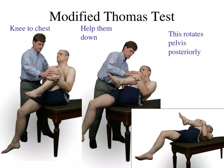 modified thomas test n.