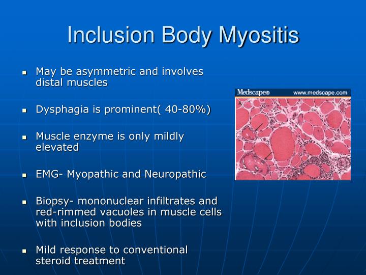 PPT Internal Medicine Clinical Pathological Conference PowerPoint