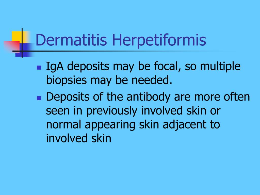 PPT - Chronic Blistering Dermatoses Part 2 PowerPoint Presentation ...