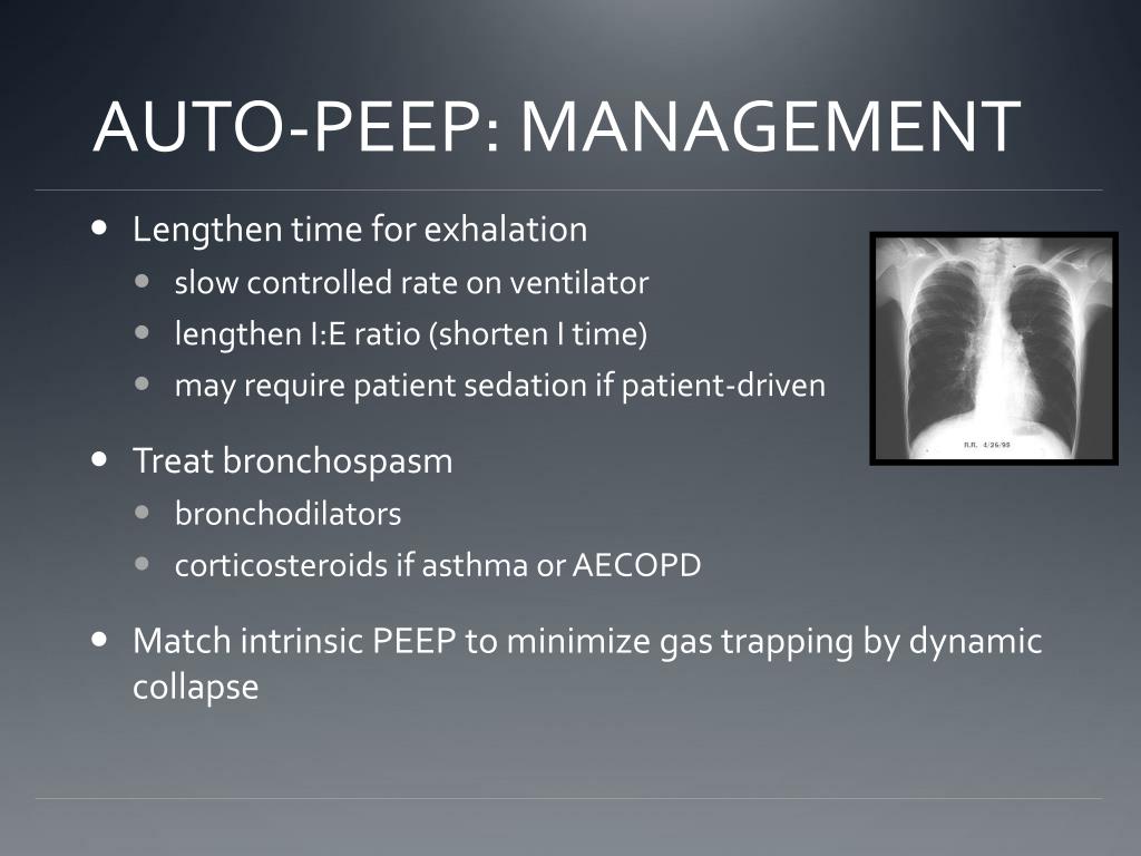 PPT VENTILATION FOR THE SURGICAL RESIDENT PowerPoint Presentation