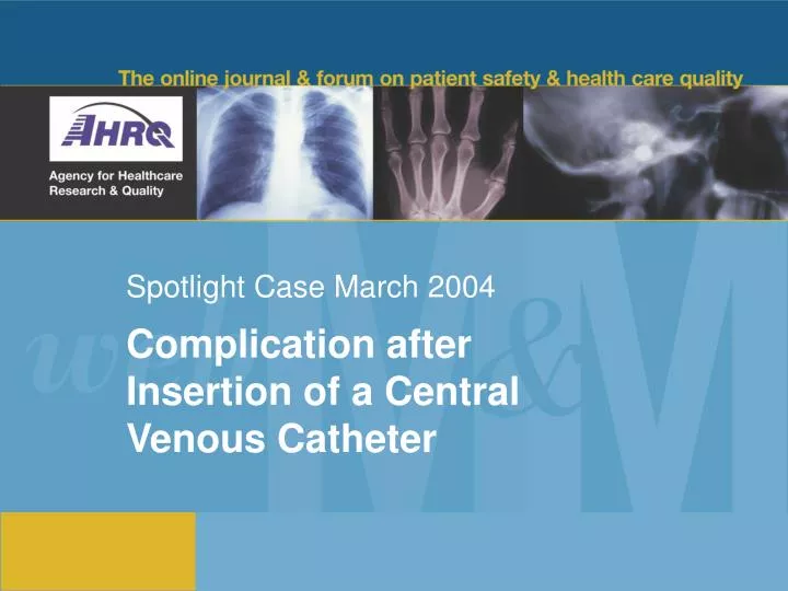 spotlight case march 2004 n.