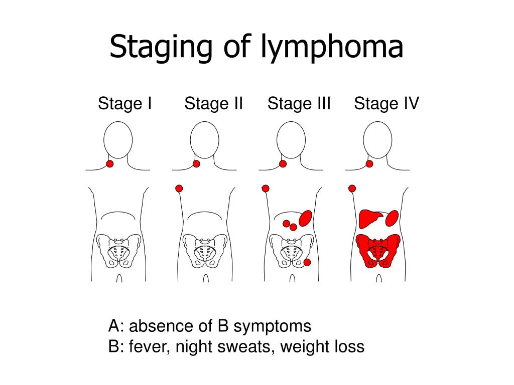 first presentation of lymphoma