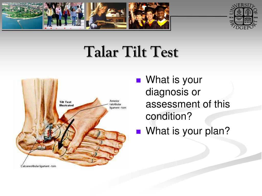 Ankle Orthopaedic Test: Talar tilt