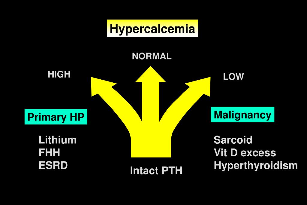 PPT - Hypercalcemia PowerPoint Presentation, free download - ID:386697