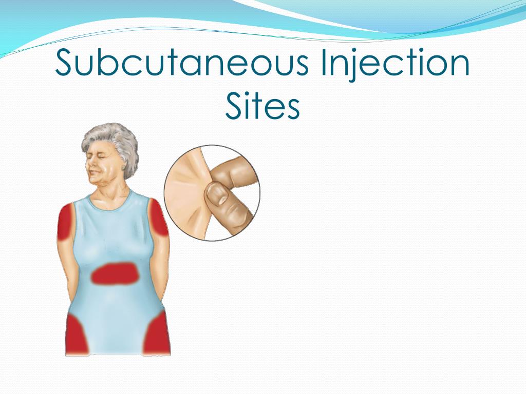 Subcutaneous