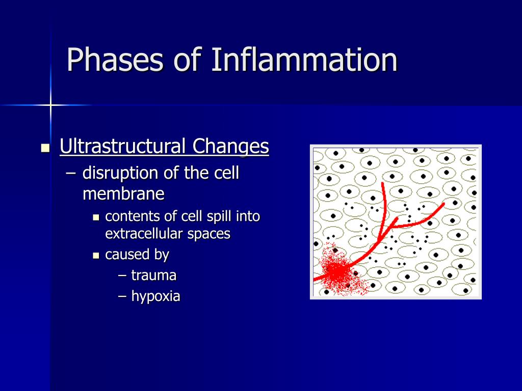 PPT  The Eight Phases of Inflammation PowerPoint Presentation, free