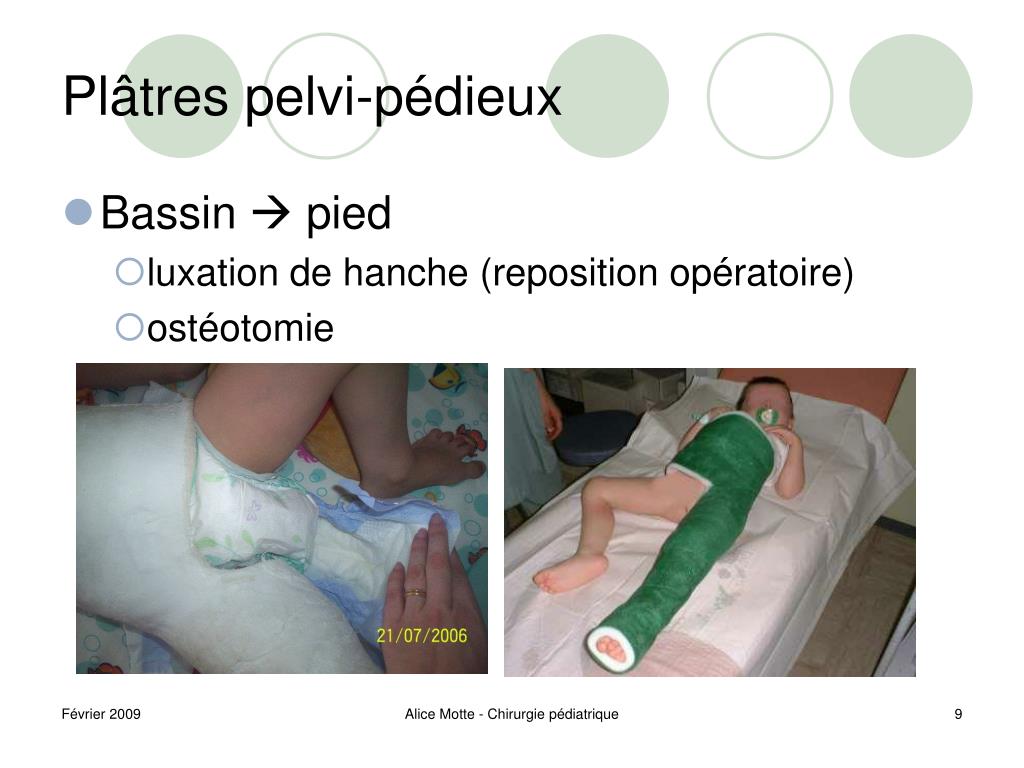 PPT - Moyens de contention en pédiatrie PowerPoint Presentation, free ...