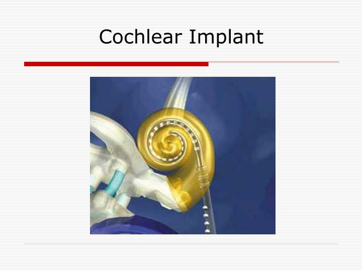 PPT - Cochlear Implant PowerPoint Presentation, Free Download - ID:389538