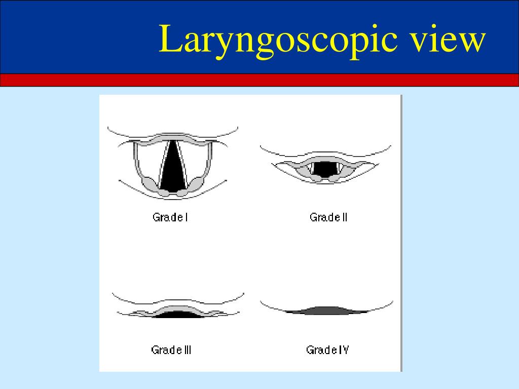 PPT Airway Management in Trauma Trauma Conference UW Hospital and Clinics Karen D. Serrano, MD