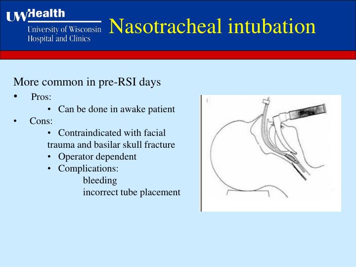 PPT - Airway Management in Trauma Trauma Conference UW Hospital and ...